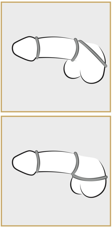 Zestaw pierścieni erekcyjnych Titan Baile Blue, silikon, 3 rozmiary